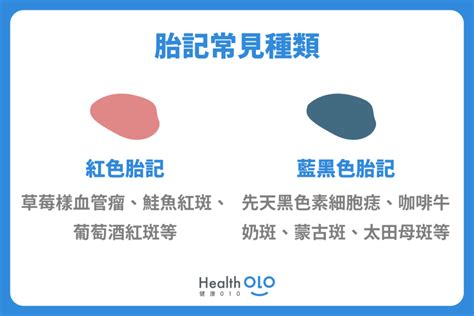 屁股胎記前世|胎記怎麼產生、何時消除？醫師剖析胎記種類、胎記寓意